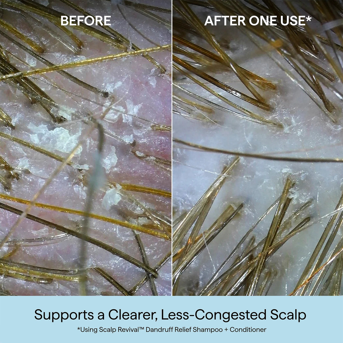 Scalp Revival™ Dandruff Relief Shampoo with Charcoal + 3% Salicylic Acid